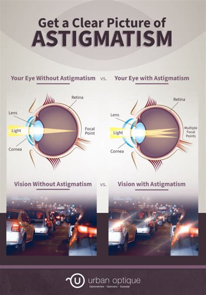 Can astigmatism cause nausea? | ContextResponse.com