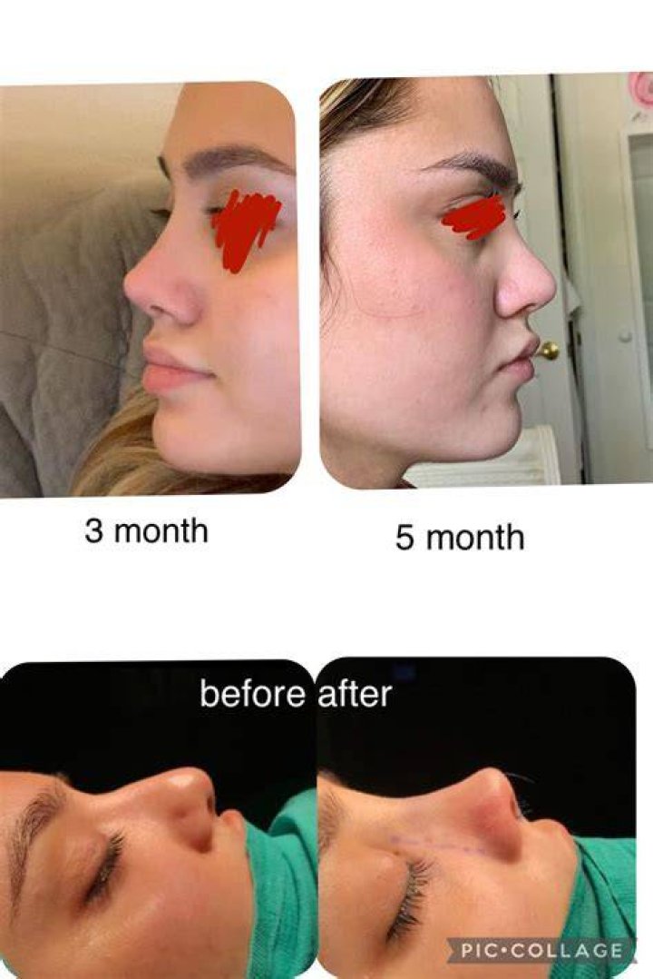 Why does my nose look bigger in photos?